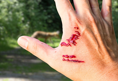 Dog Bite Injury Lawyer Orange County California