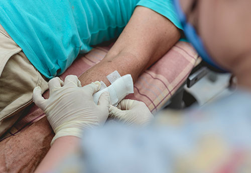 Dog Bite Injury Lawyer Orange County California