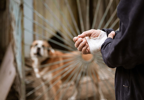 Dog Bite Injury Lawyer San Diego California