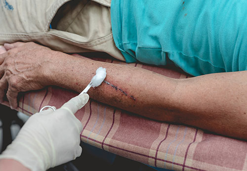 Dog Bite Injury Lawyer San Diego California